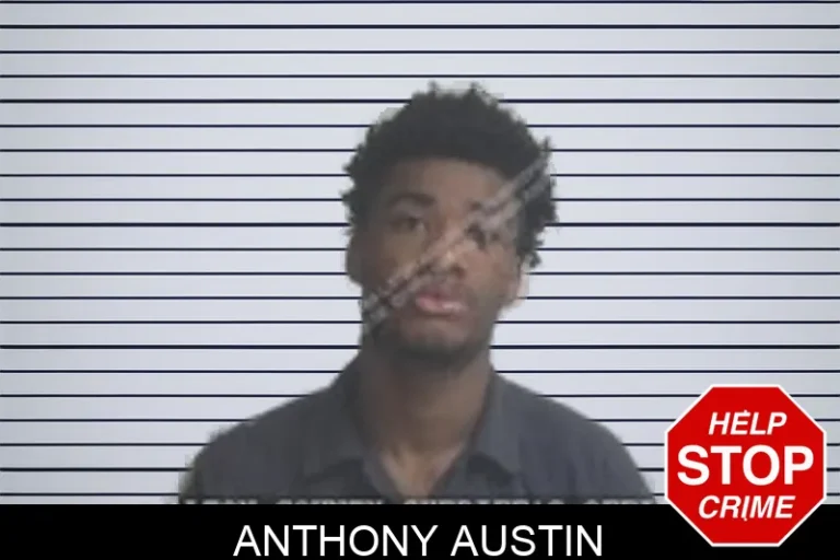 Anthony Austin