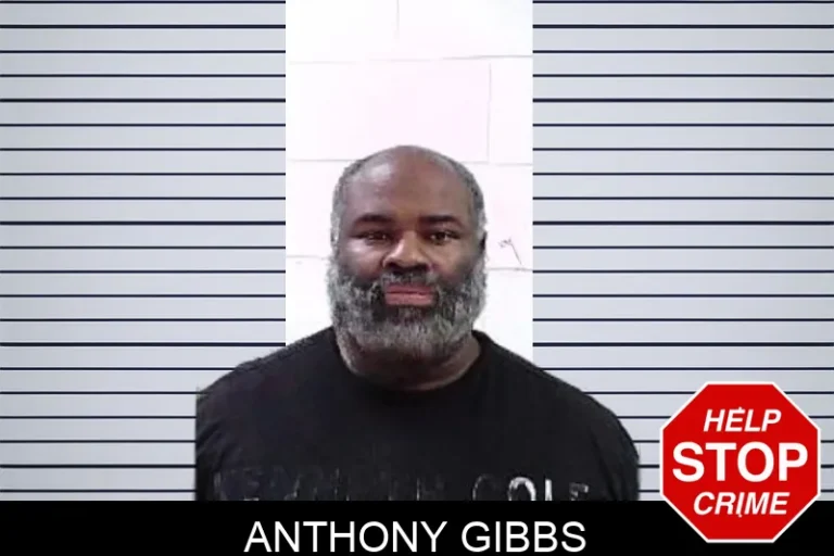Anthony Gibbs