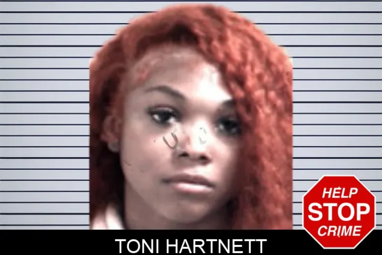 Toni Hartnett