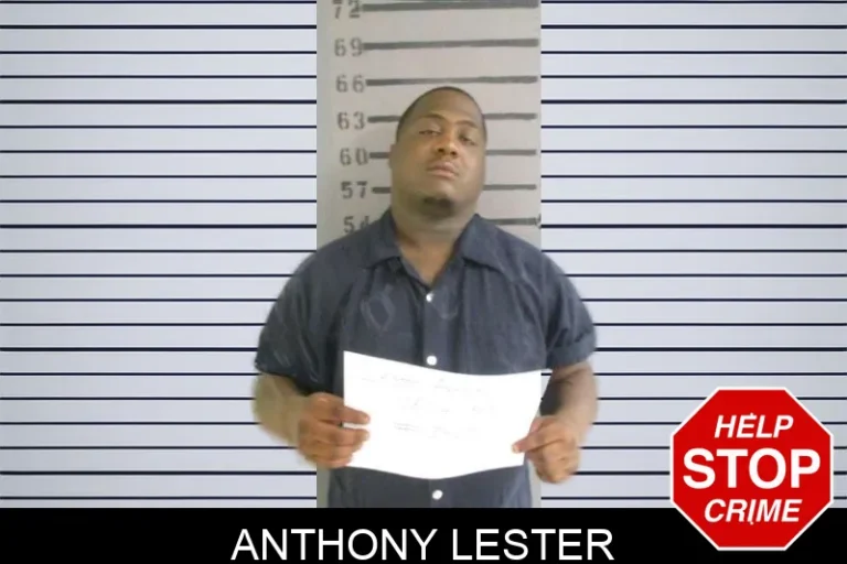 Anthony Lester