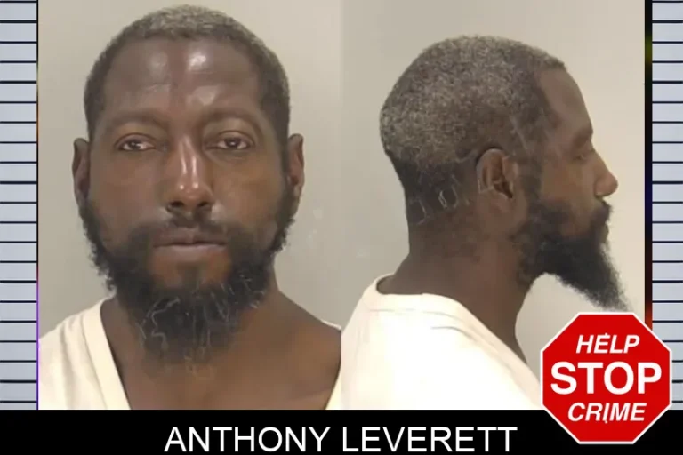 Anthony Leverett