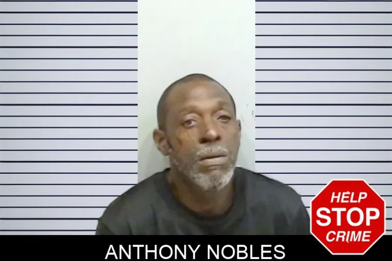 Anthony Nobles