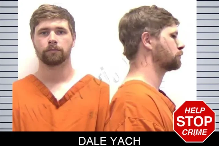 Dale Yach