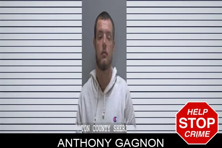 Anthony Gagnon