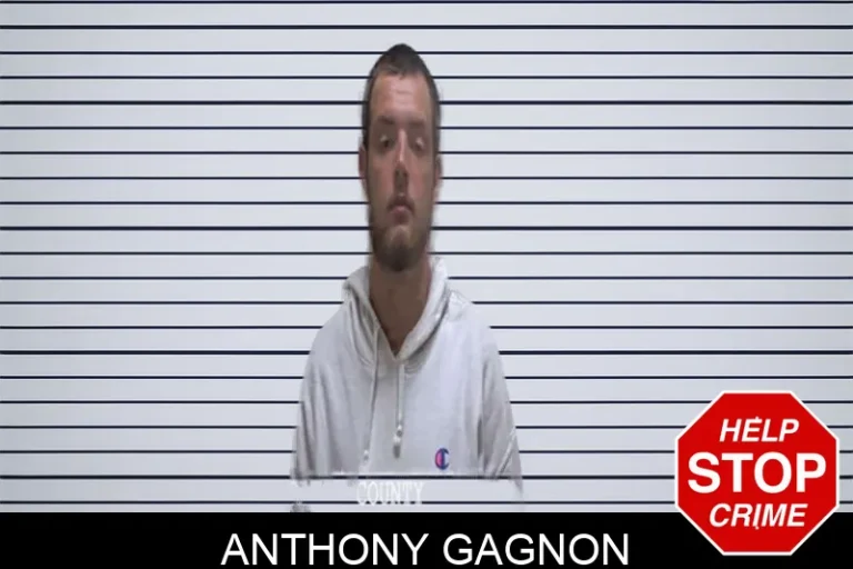 Anthony Gagnon