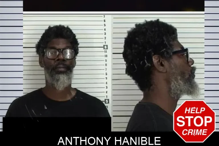 Anthony Hanible
