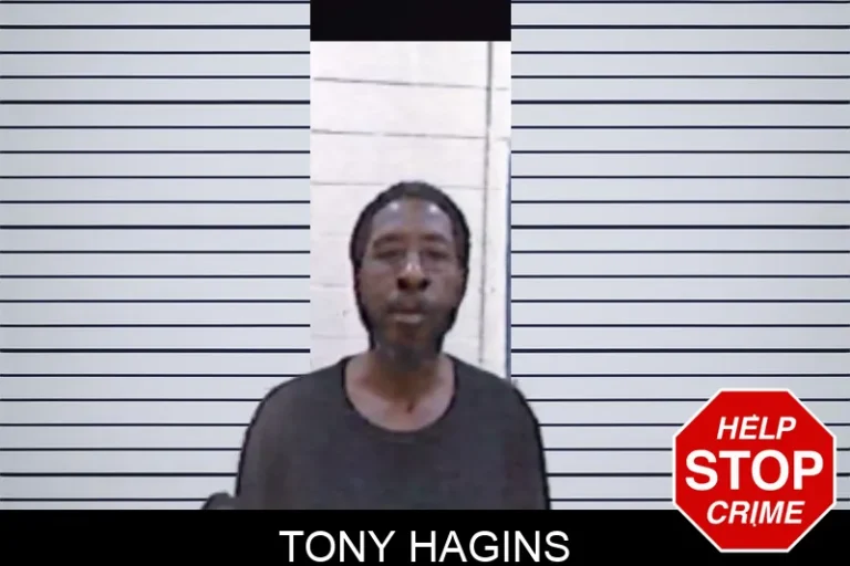 Tony Hagins