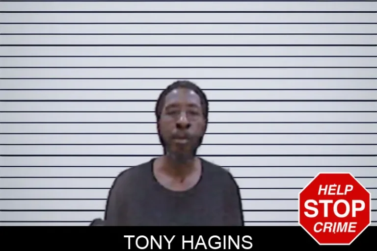 Tony Hagins