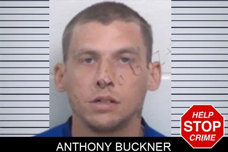 Anthony Buckner