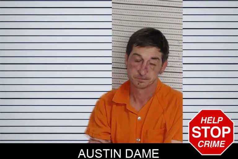 Austin Dame