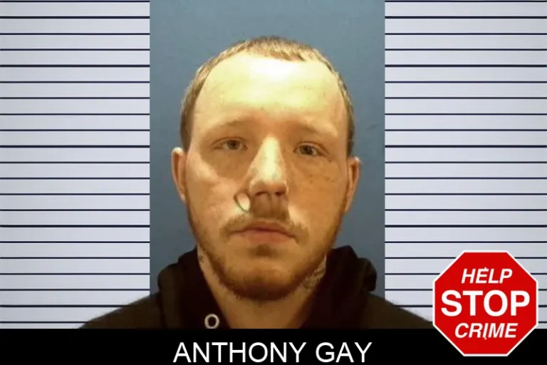 Anthony Gay