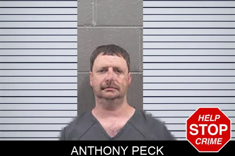Anthony Peck