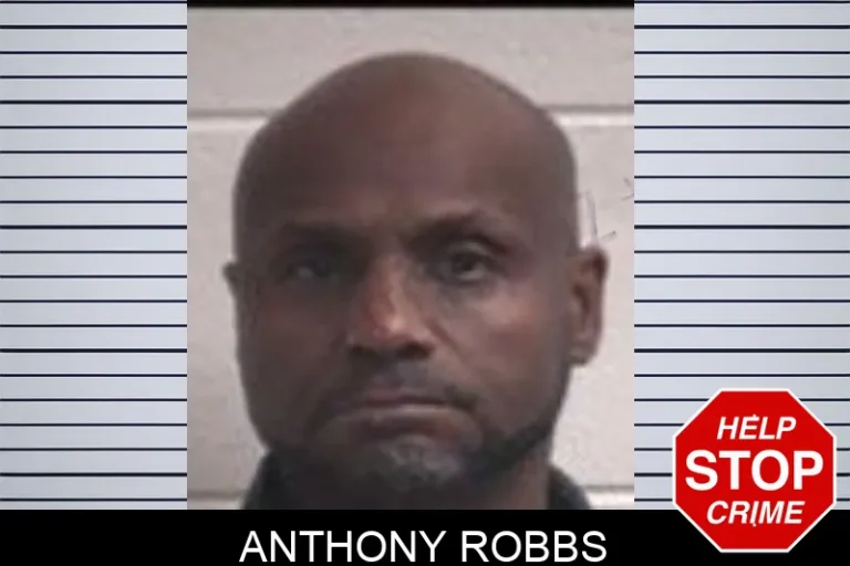 Anthony Robbs