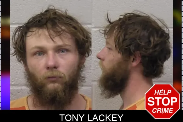 Tony Lackey