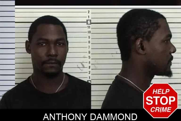 Anthony Dammond