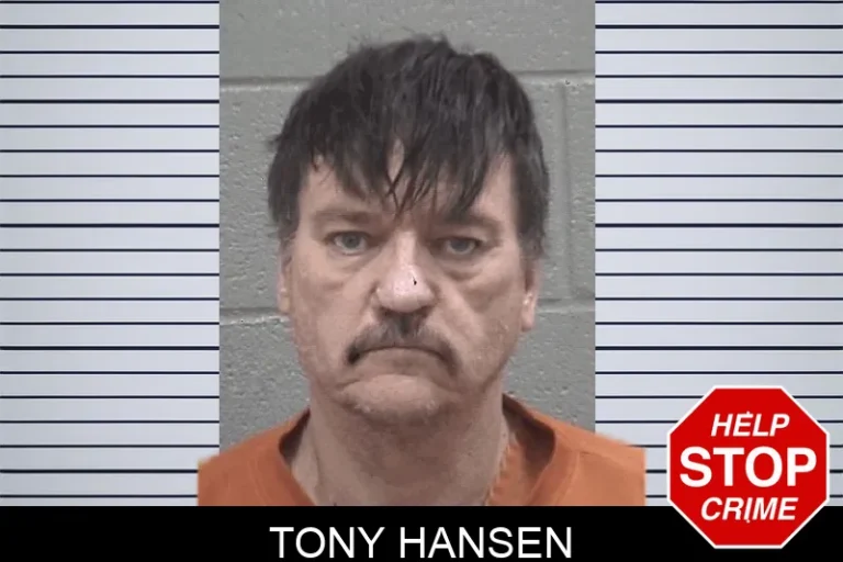 Tony Hansen