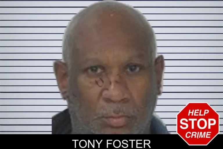 Tony Foster