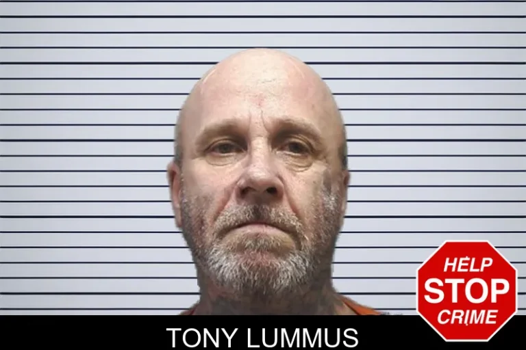 Tony Lummus