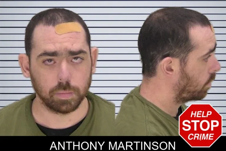 Anthony Martinson