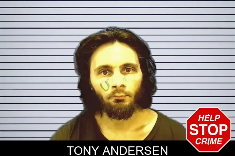Tony Andersen