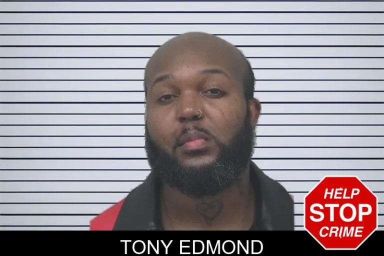 Tony Edmond
