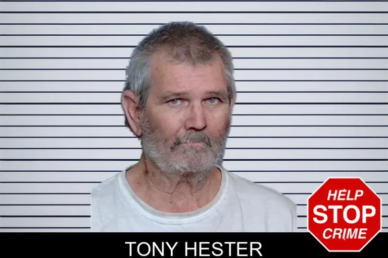Tony Hester