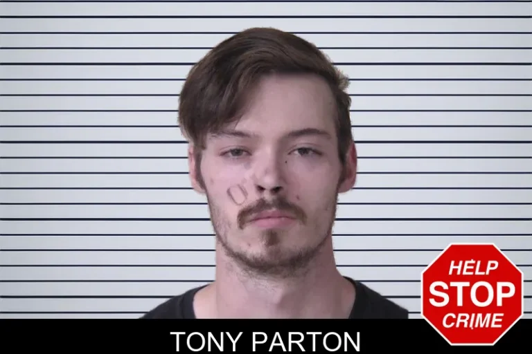 Tony Parton