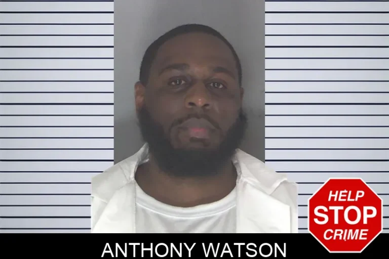 Anthony Watson