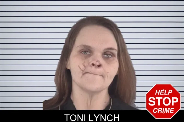 Toni Lynch