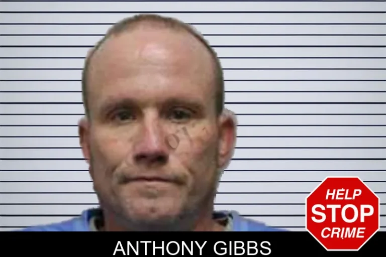 Anthony Gibbs