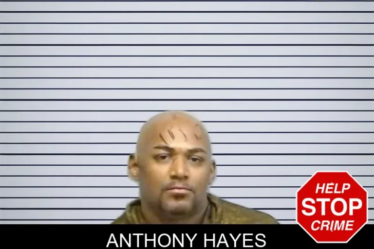 Anthony Hayes