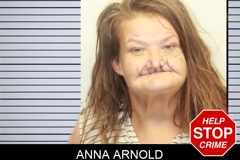 Anna Arnold mugshot